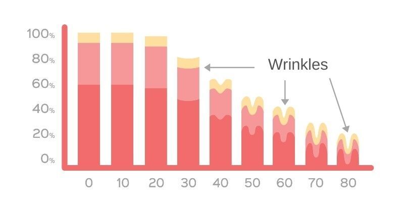 chart, bar chart